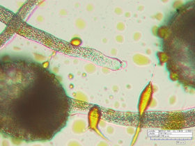 Enlarged view: Germinated Pollen Tubes